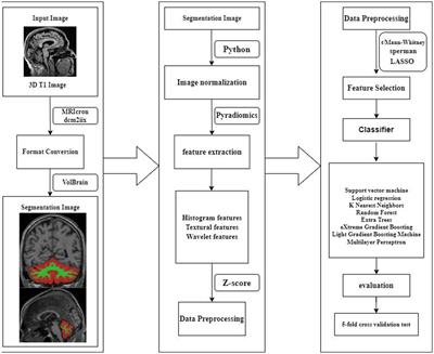 MRI radiomics combined with machine learning for diagnosing mild cognitive impairment: a focus on the cerebellar gray and white matter